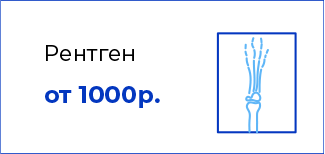 Рентген